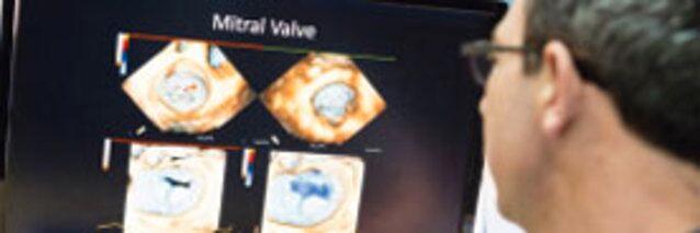 The Whole Story - Revolutionized Treatment of Valvular Disease