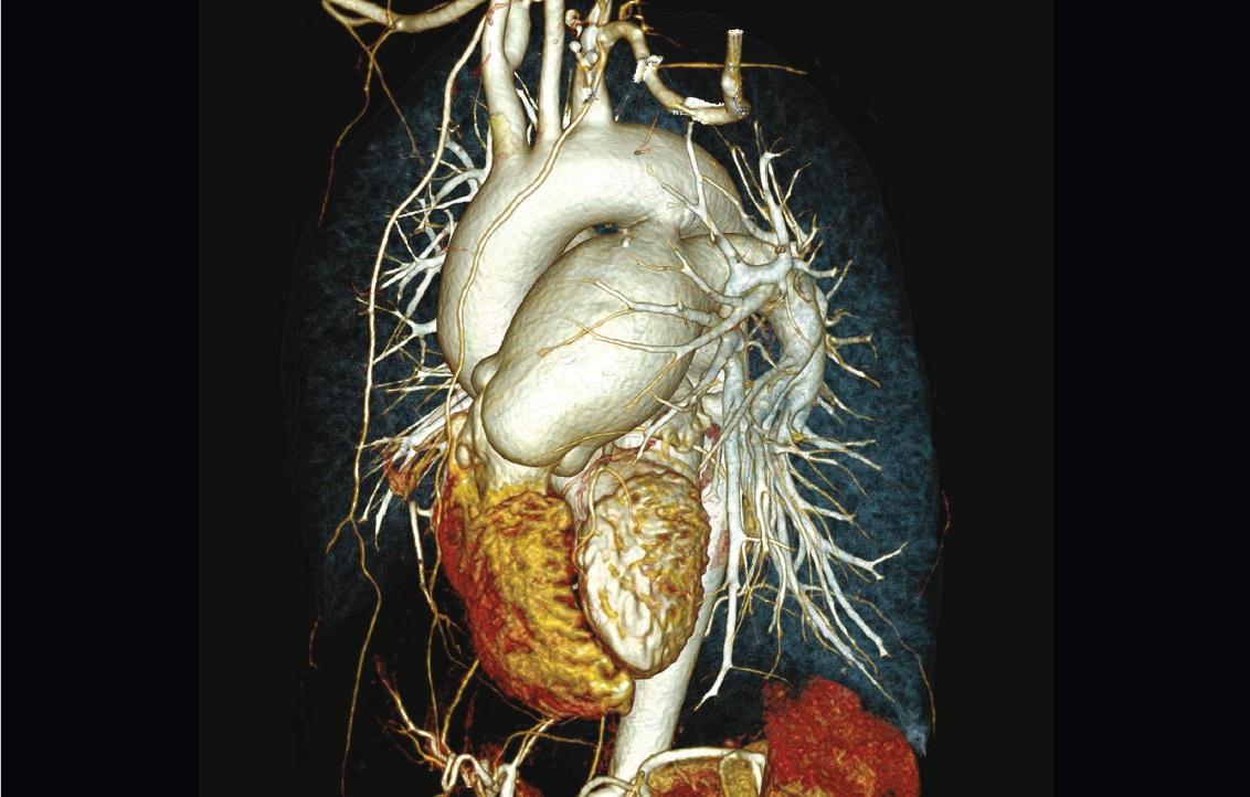 AH Kardiologiczny MRI
