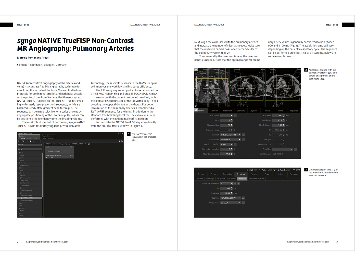 Siemens-healthineers_Magnetomworld_Marcelo_Native