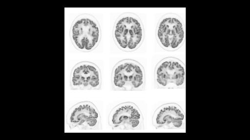 Biograph PET/CT family - Siemens Healthineers