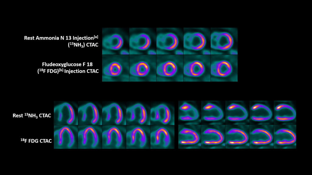 Biograph mCT PET/CT scanner - Siemens Healthineers USA