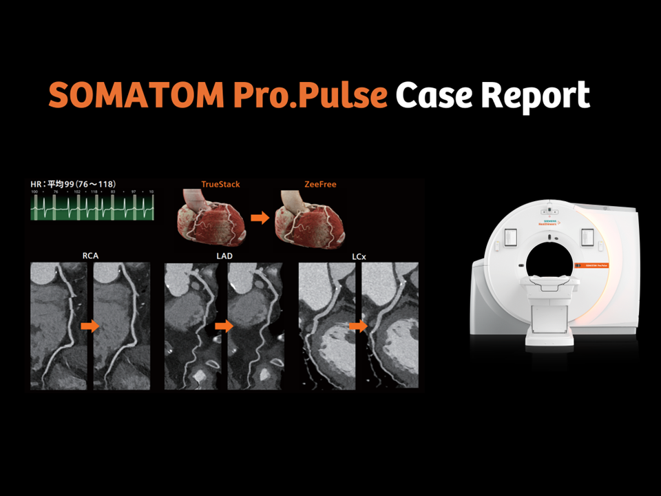SOMATOM Pro.Pulse Case Report vol.1_teaser
