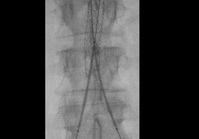 Siemens-healthineers-clinical-case-cios-alphaneo-CREAB