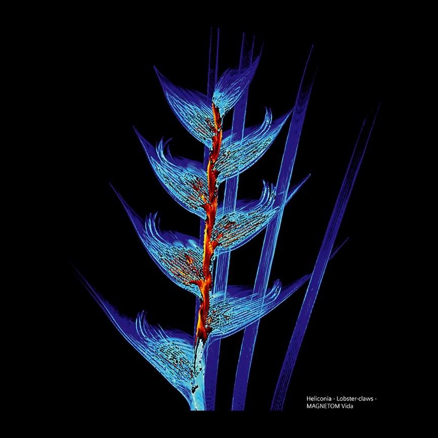 Siemens-healthineers_Magnetomworld_Helicona_Vida