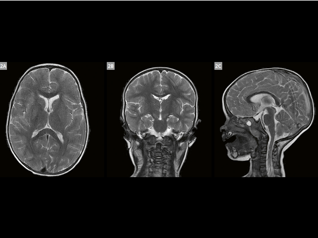 Siemens-healthineers_Magnetomworld_Brain-MRI