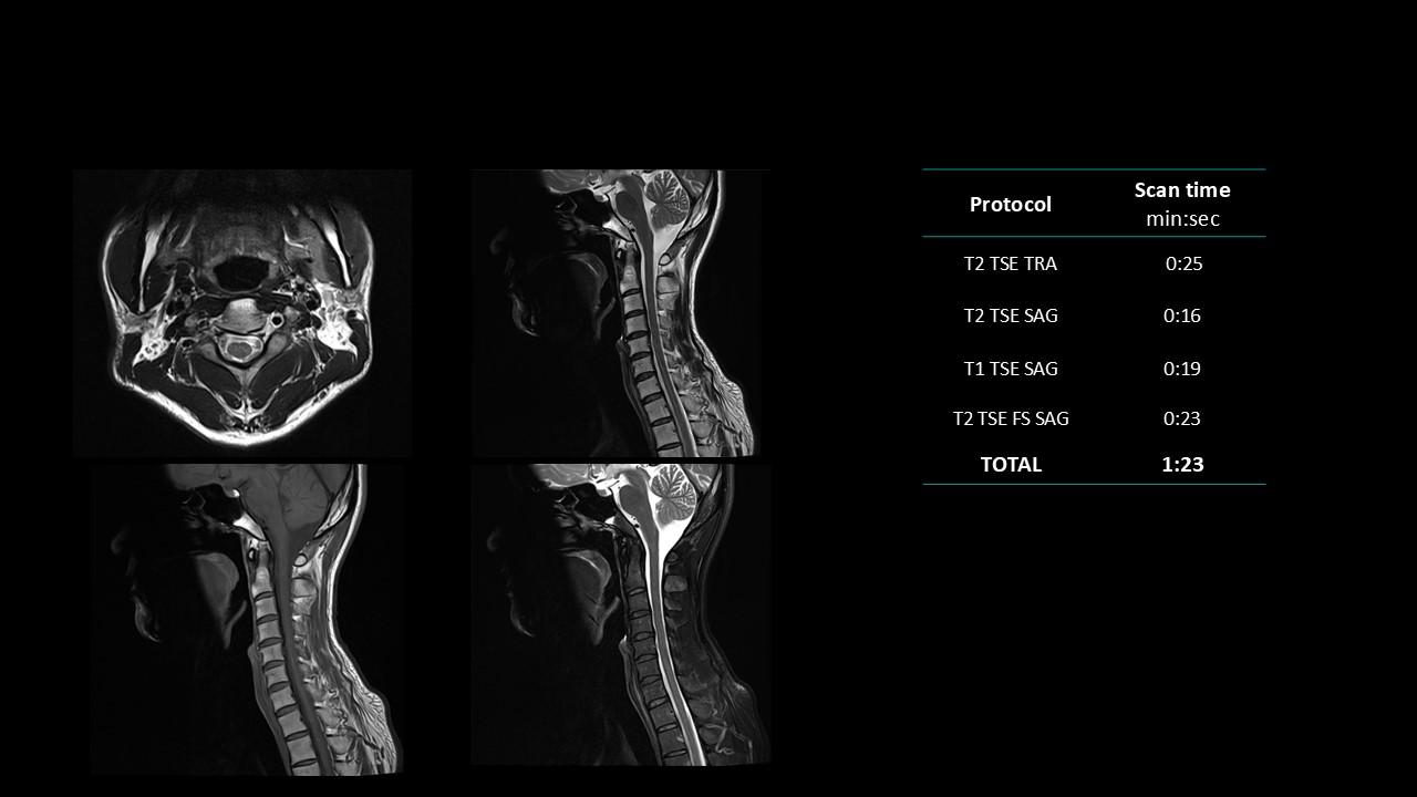 siemens-healthineers_magnetomworld_C-spine-rountine