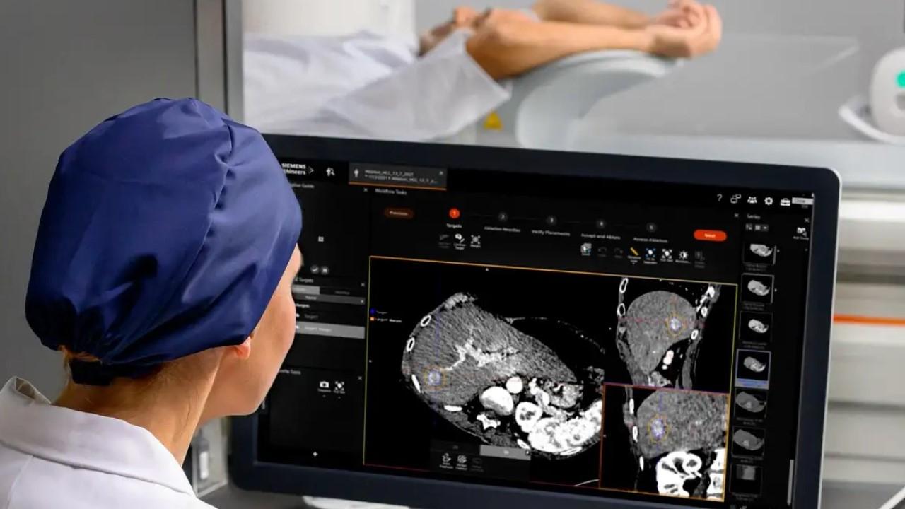 Interventional Oncology