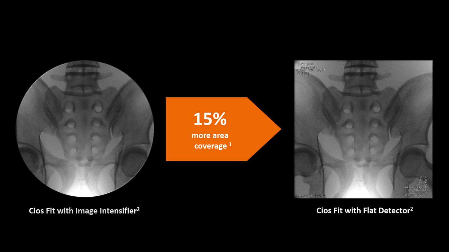 Enhanced 2D image quality with Cios Fit, a mobile C-arm for surgery.