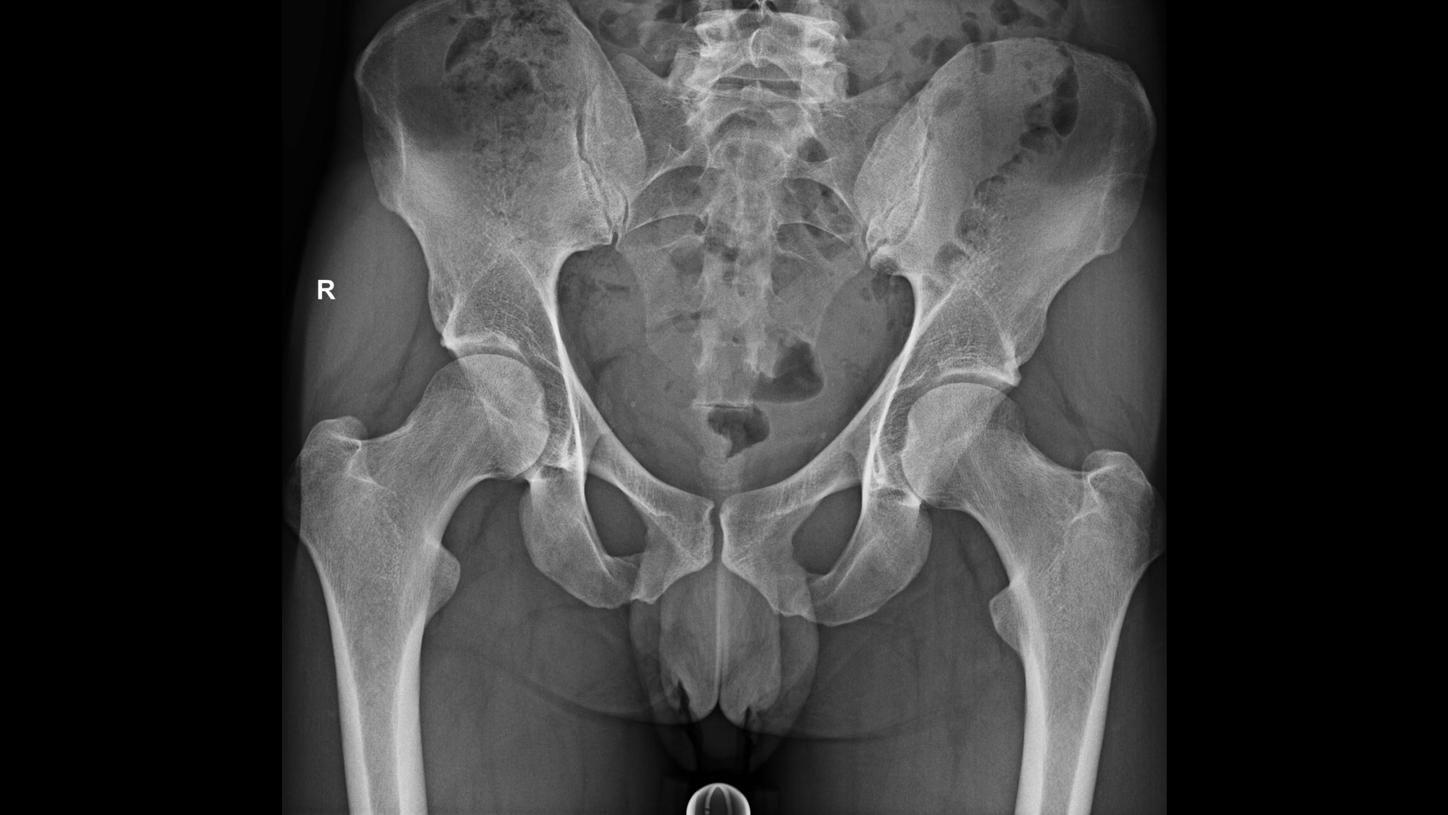 DI XP Luminos Qnamix Pelvis