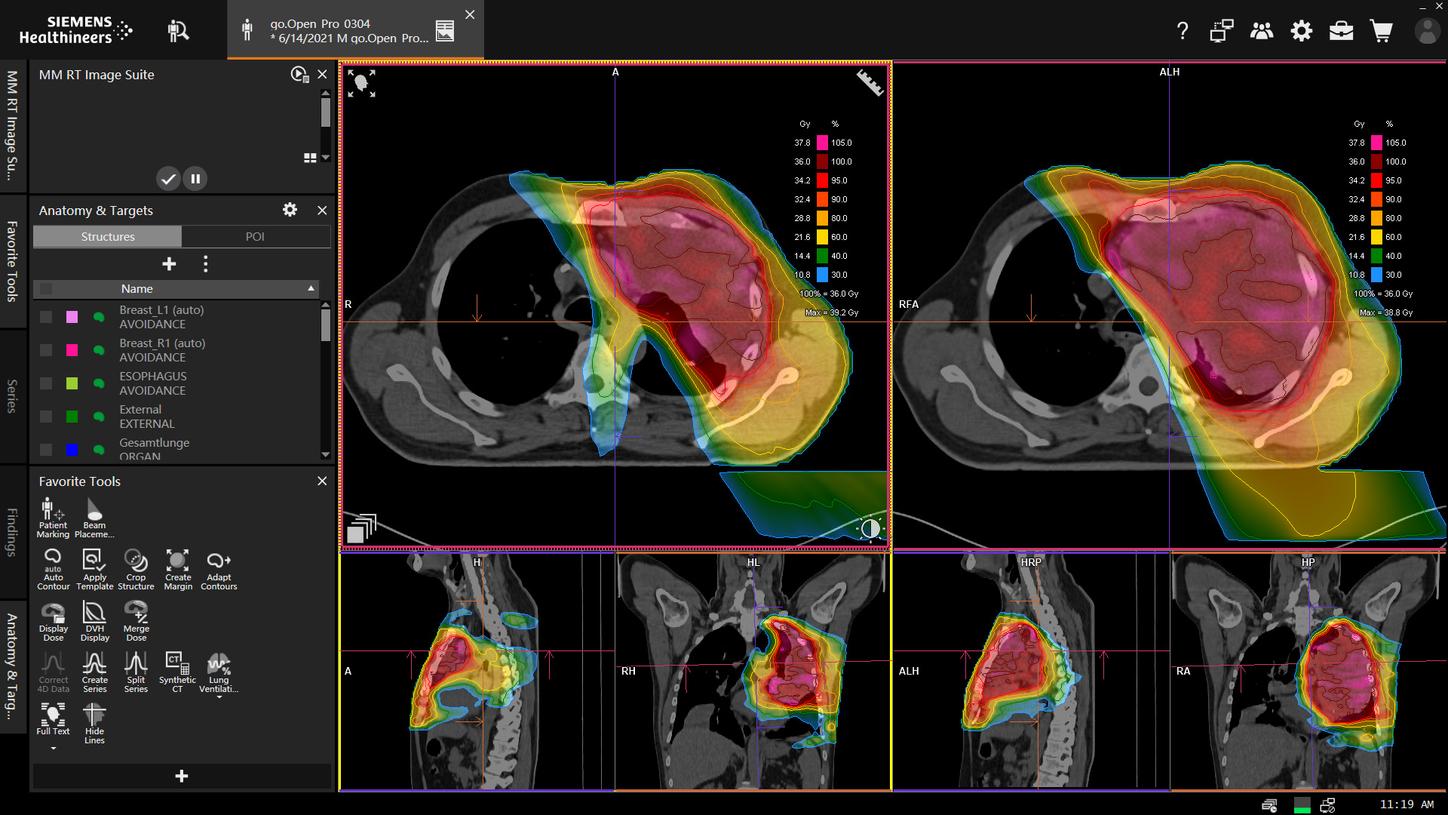 Siemens Healthineers syngo.via RT Image Suite