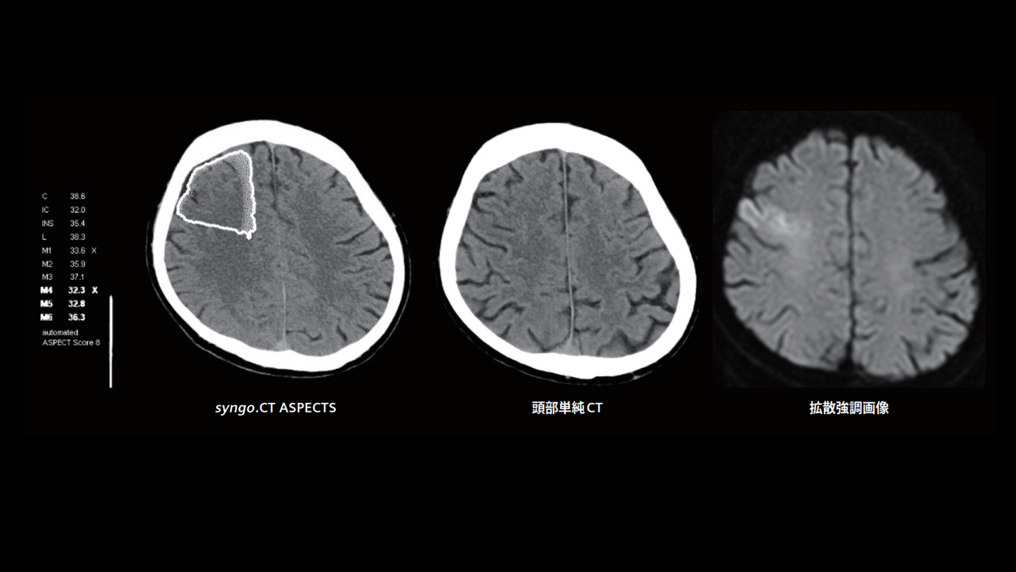 JP-CT-Pro.Pulse_CaseRport_vol.1-2