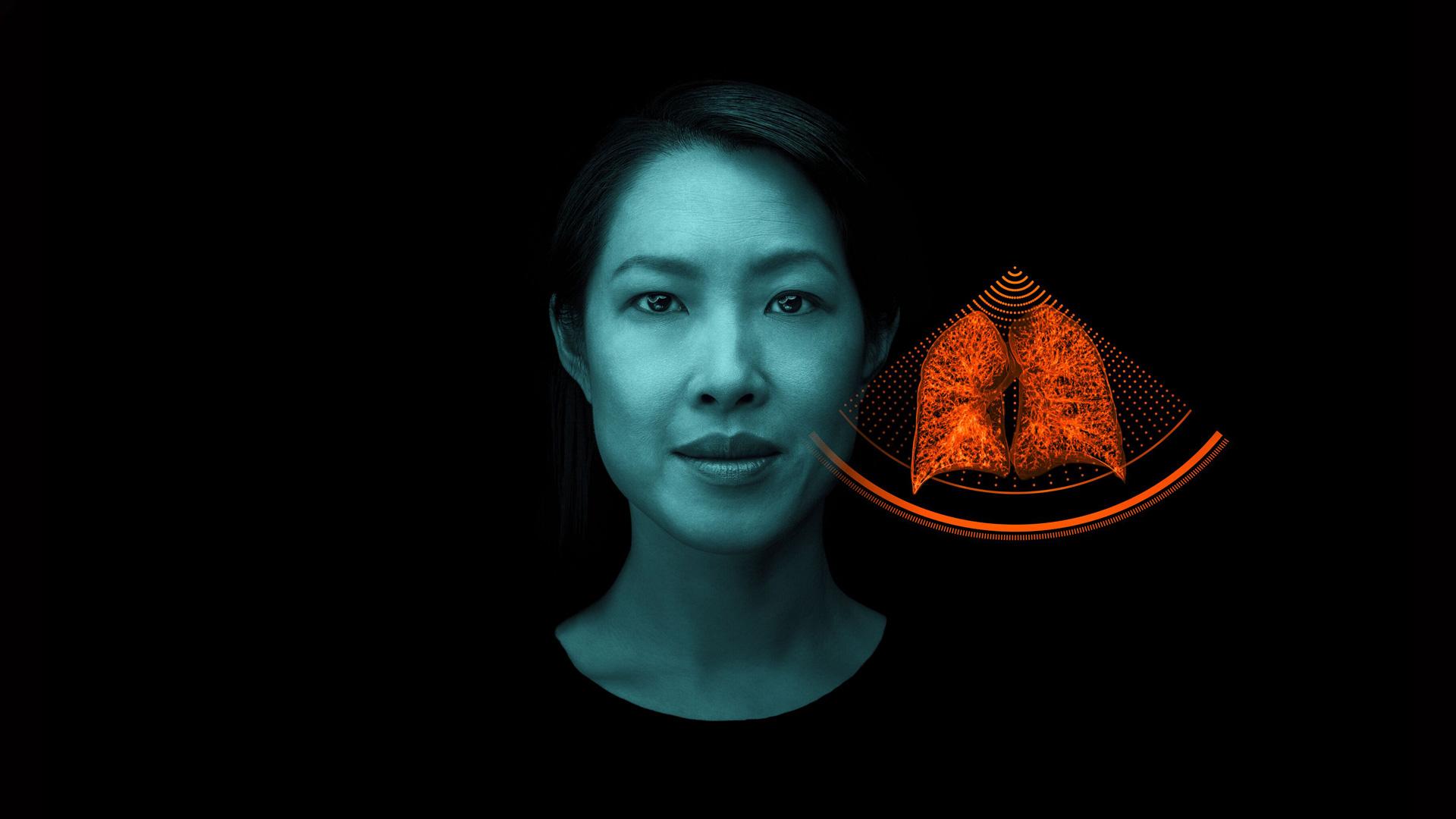 PCCT pulmonology imaging Siemens Healthineers