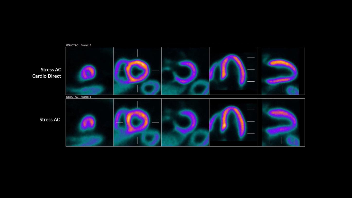 Dynamic scan for the assessment of myocardial perfusion and blood flow