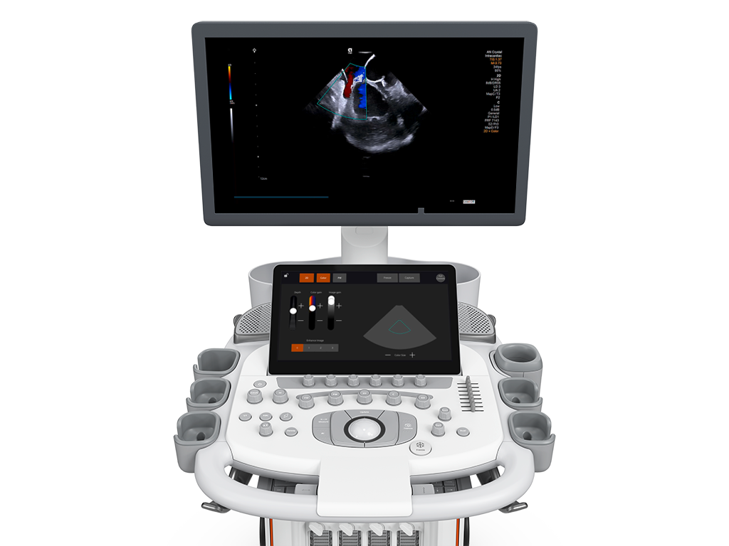 Dedicated EP touchscreen on ACUSON Origin