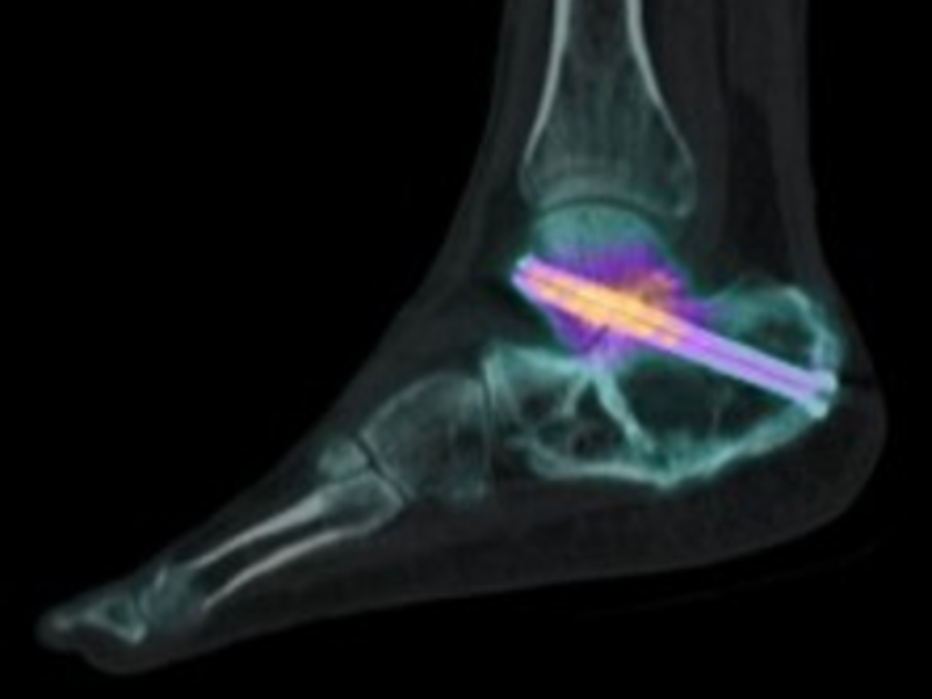 Molecular Imaging Systems