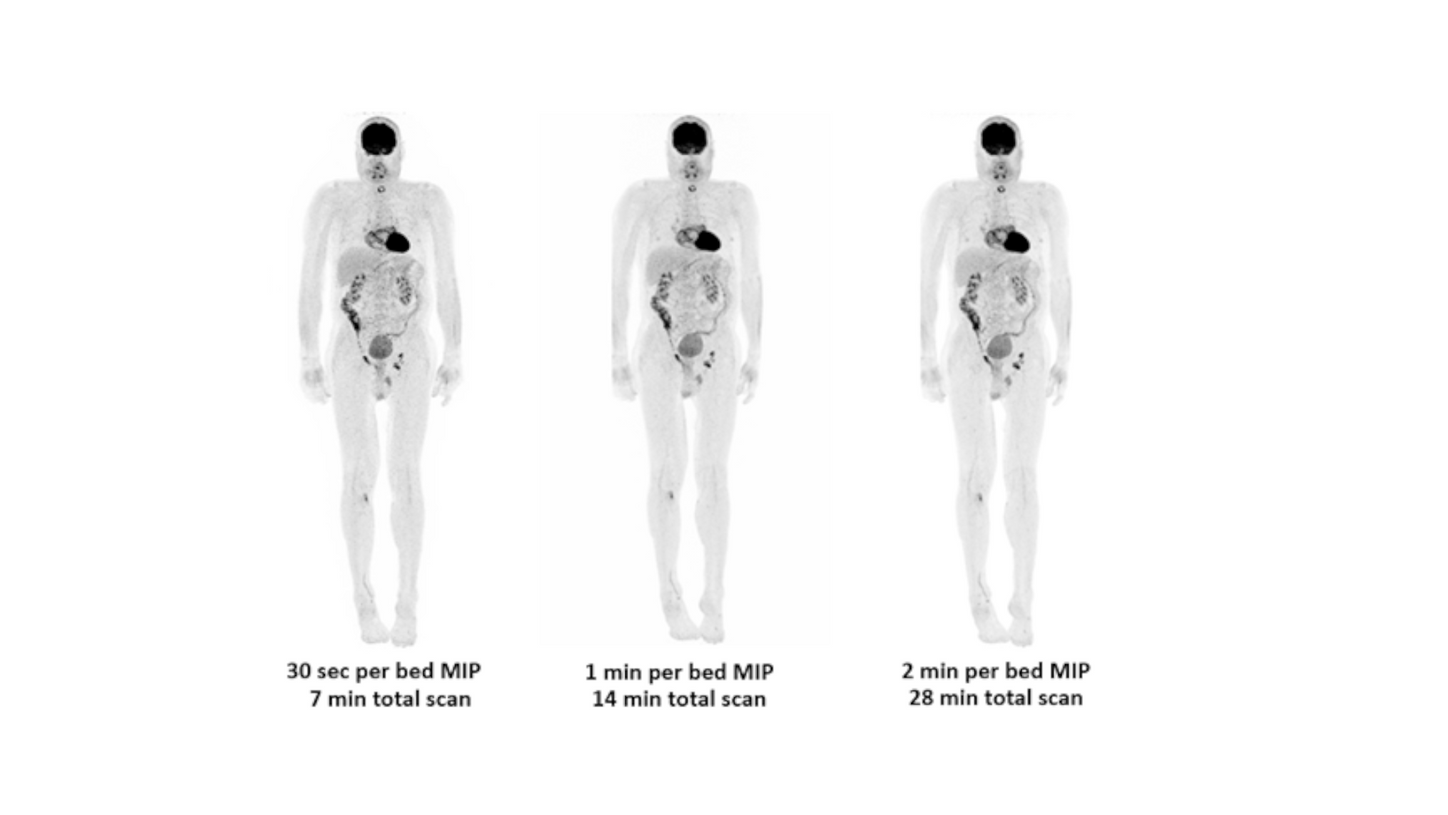 Biograph Vision clinical image 5