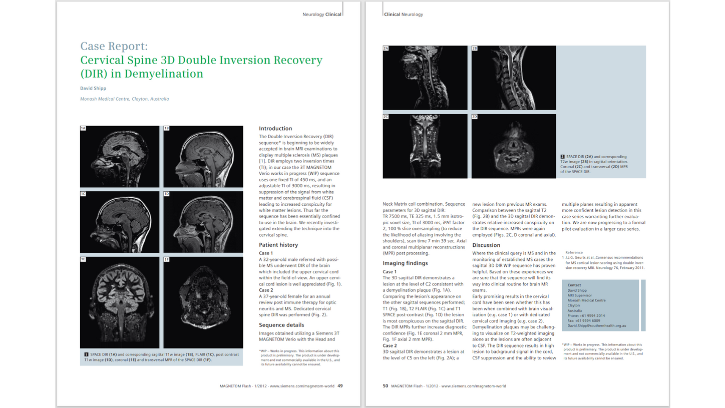 siemens-healthineers_Magnetomworld_Case-Report-Cervical-Spine