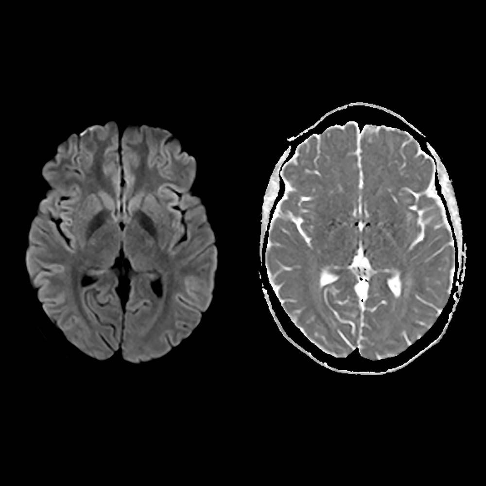 Siemens Healthineers Biomatrix MRI RESOLVE