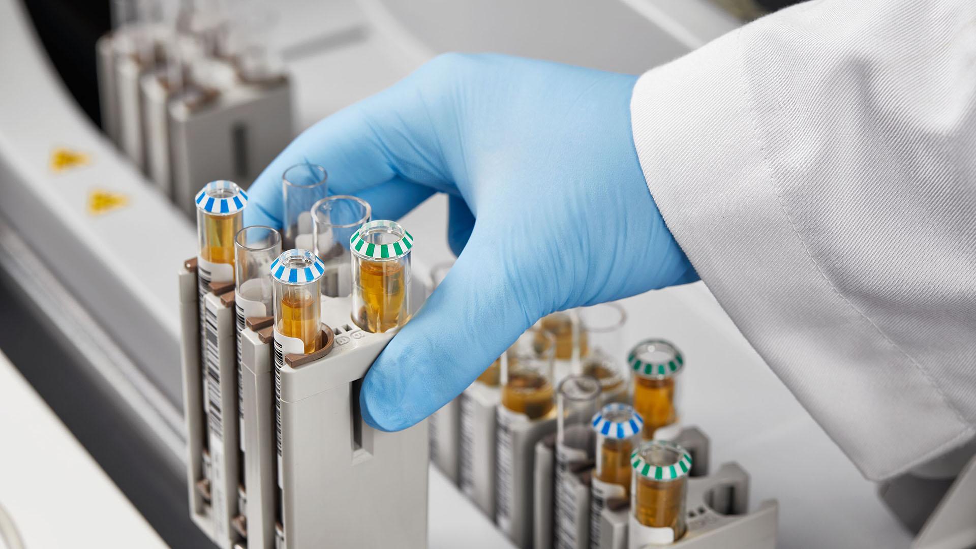 Atellica CI Analyzer - Siemens Healthineers - Siemens Healthineers