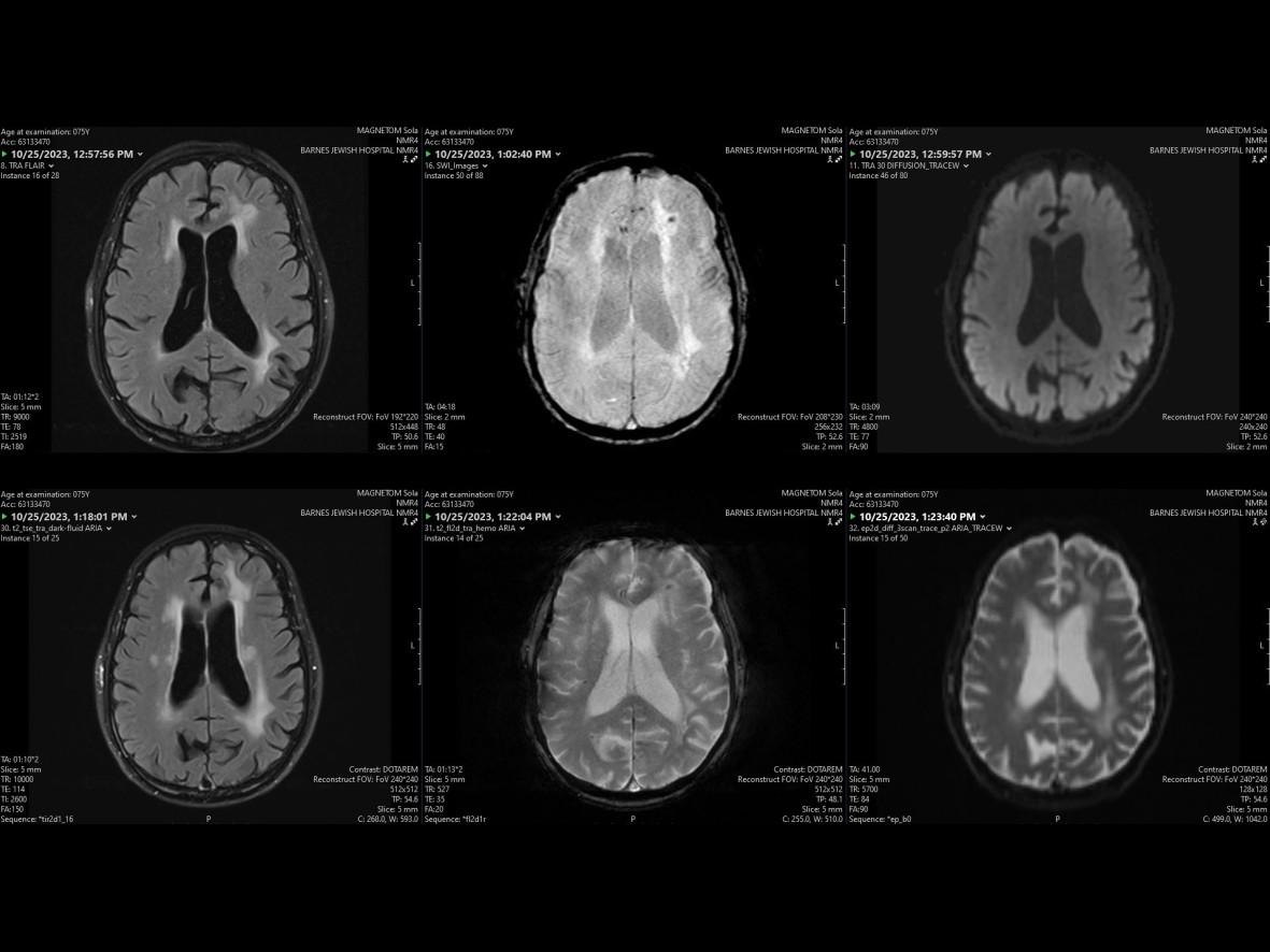 AD Therapeutic Imaging Protocols