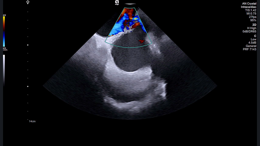 Dedicated EP control panel