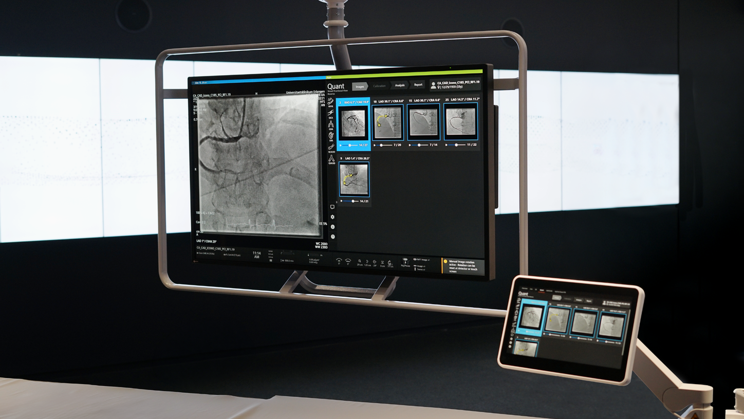 QuantWeb vFFR - angiobased FFR