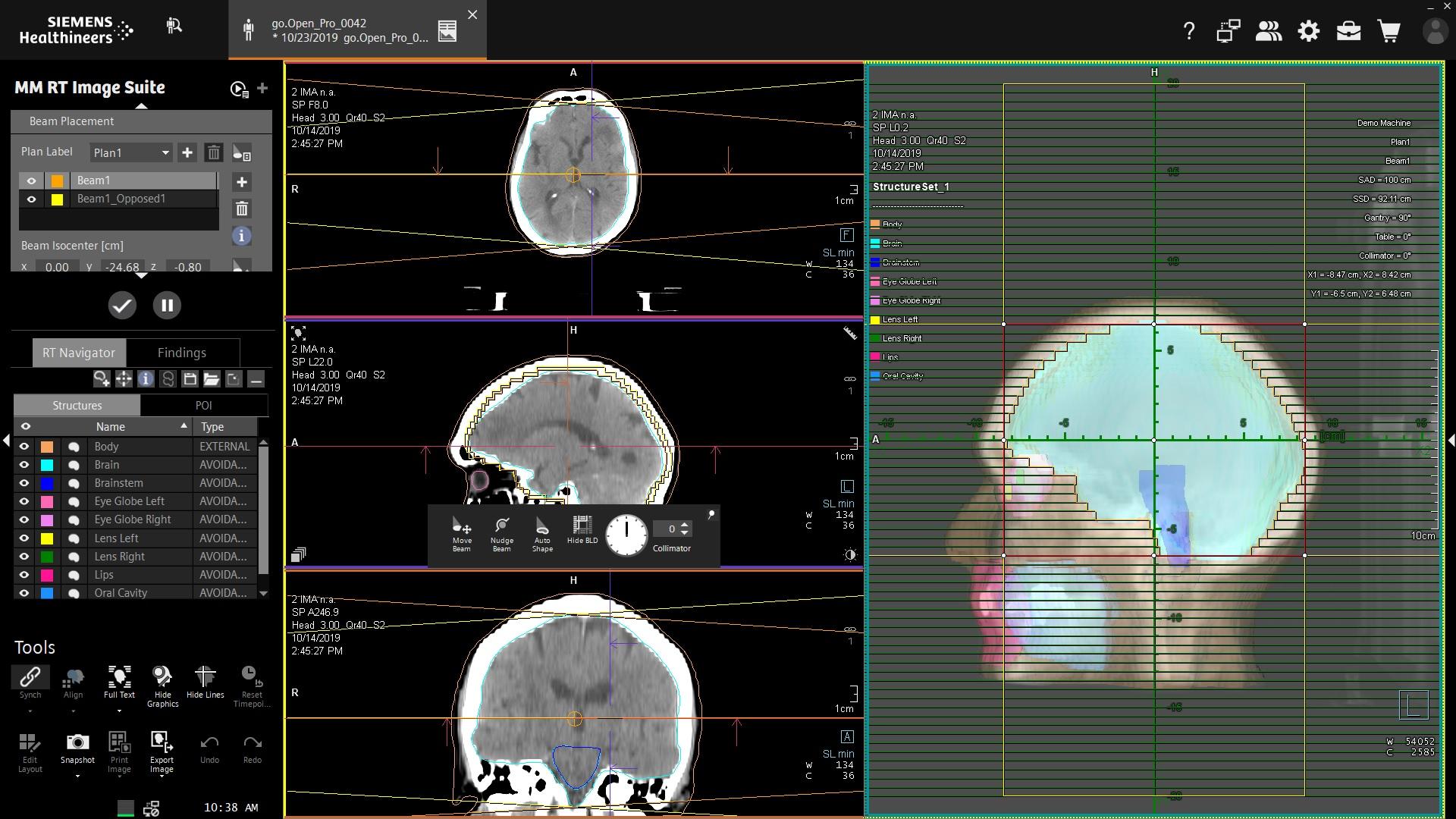 syngo.via RT Image Suite - Siemens Healthineers