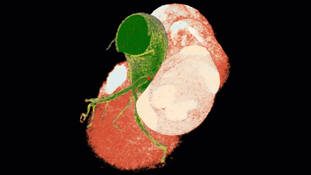 clinical_proof_1_CT_techniques1