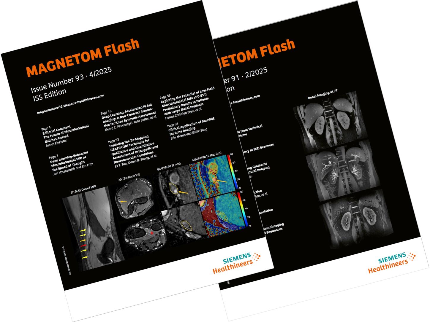 MAGNETOM Flash<br /><br />