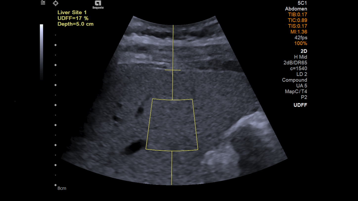 Ultraschallbild UDFF