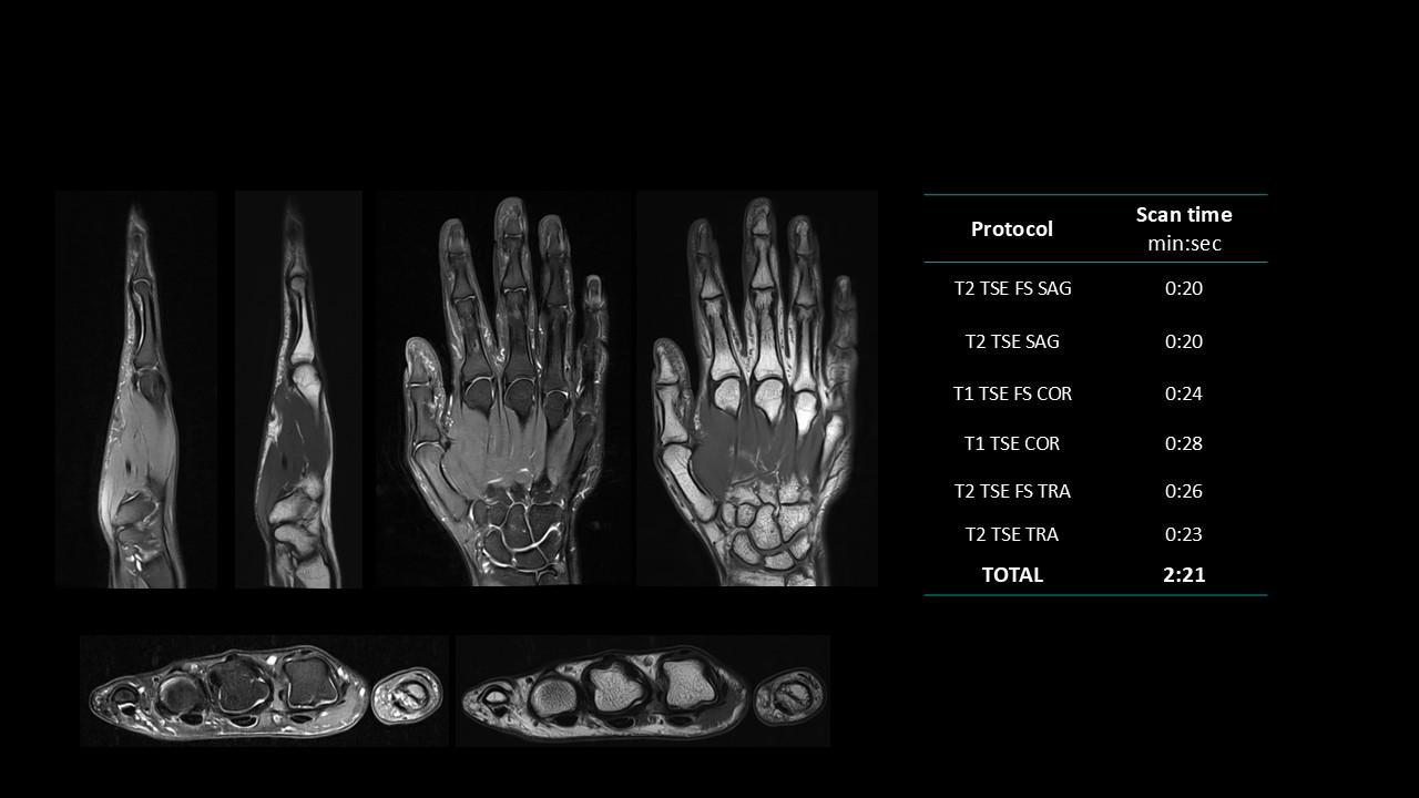 siemens-healthineers_magnetomworld_Hand-rountine