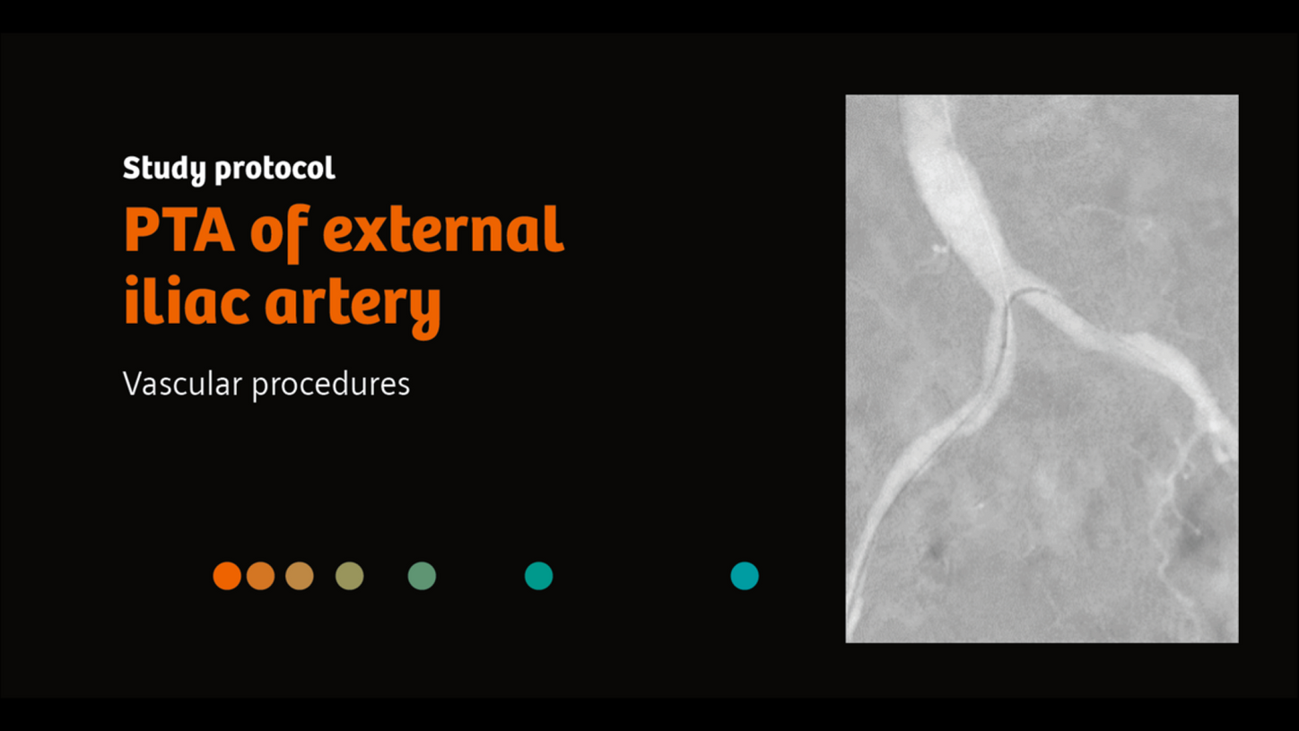 SHS AT SU PTA of external iliac artery Study Protocol