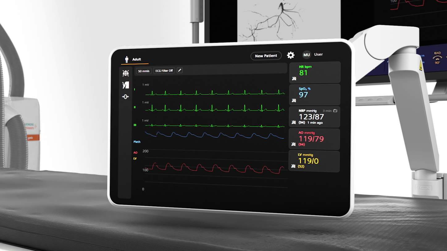 The seamless ARTIS integration is simplifying operations for the whole team. It enables fully embedded system handling in both the control room and examination room – with the added flexibility of optional access via the ARTIS Touch UI.