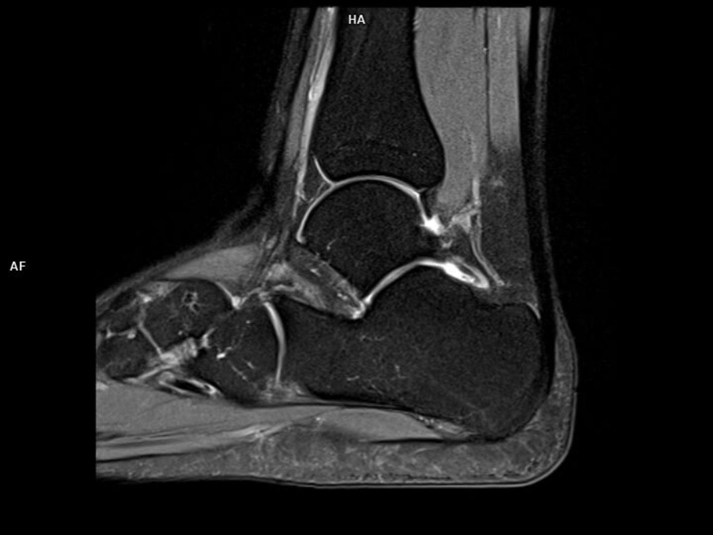 PD FS Sag-MAGNETOM Sola