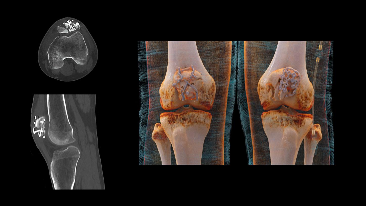 SOMATOM Edge Plus - Clinical Image