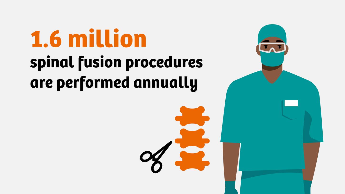 Illustrations of a surgeon with the text, "1.6 million spinal procedures are preformed annually"