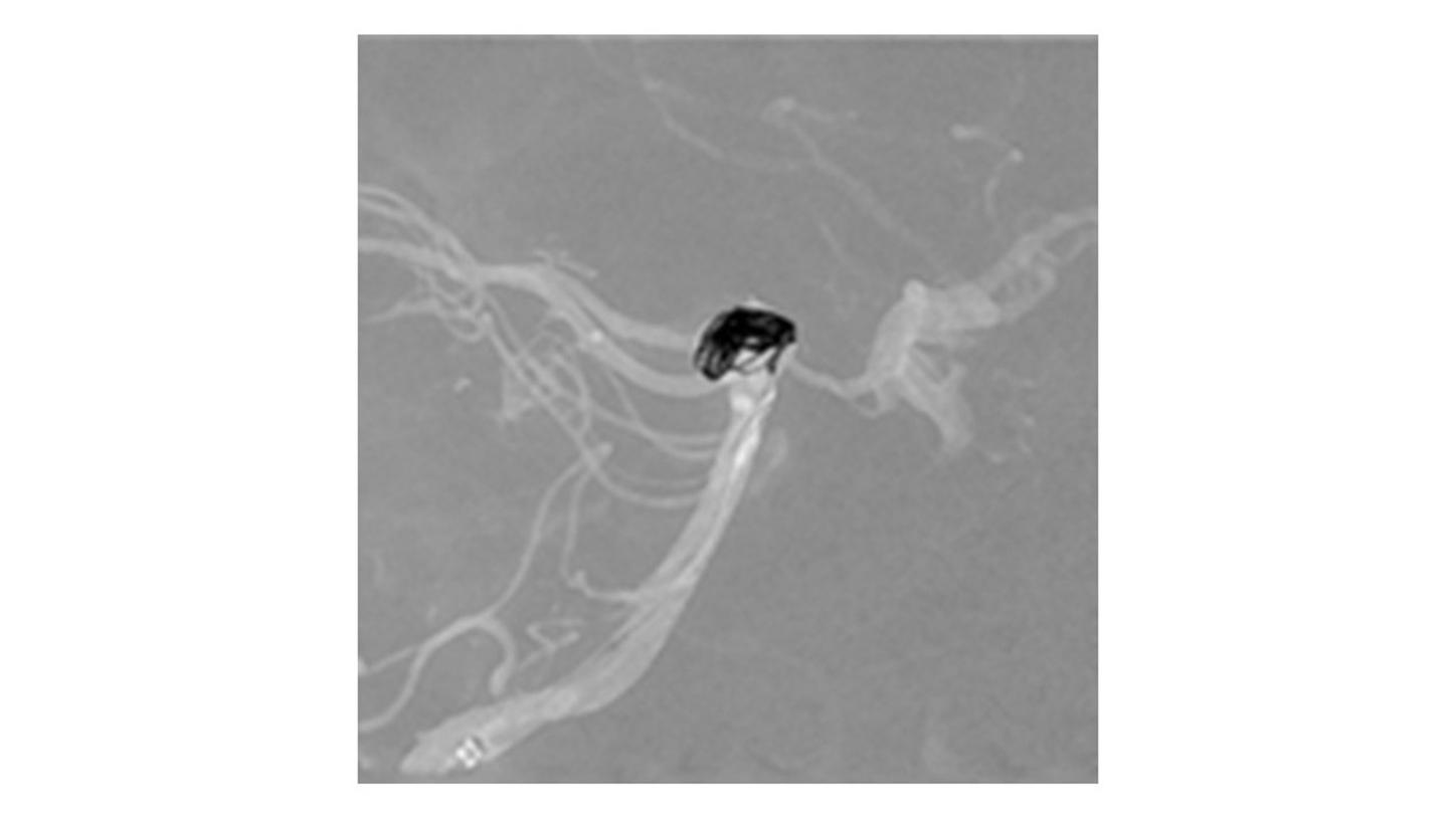 OPTIQ AI Material-specific imaging image