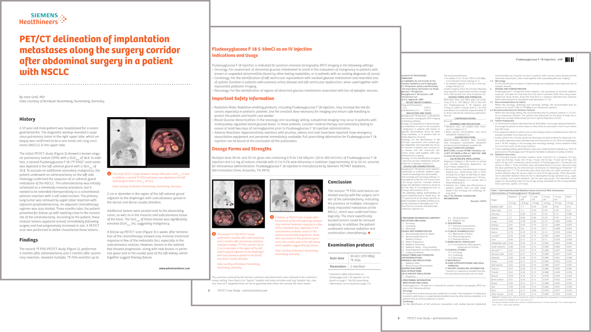 Diagnosis And Treatment Of Lung Cancer - Siemens Healthineers