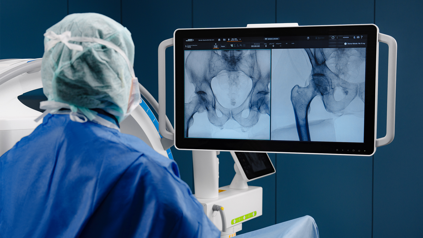 Surgeon using Cios Go ID to achieve excellent imaging performance in the operating room.