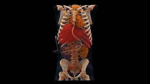 PCCT cardiovascular imaging - Siemens Healthineers