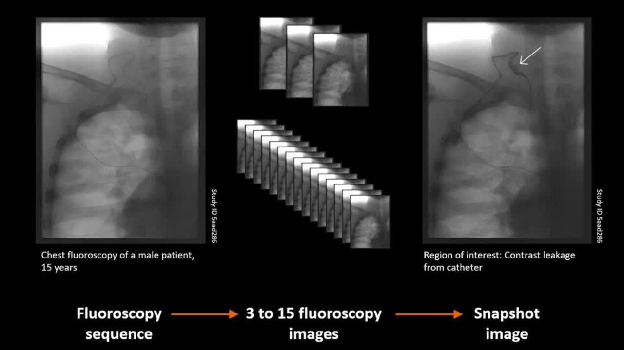 Snapshot_Mode_Clinical_Workflow_6350136511112