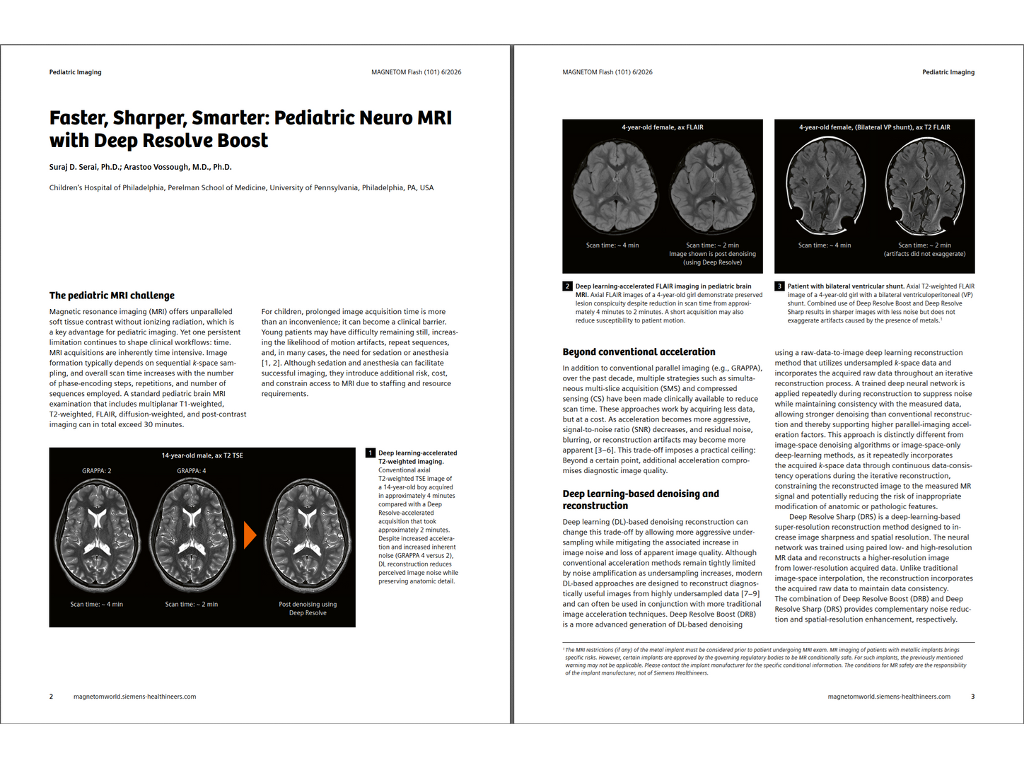 Siemens-healthineers_Magnetomworld_Serai_Ped_Neuro