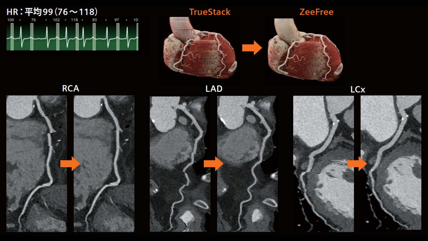 JP-CT-Pro.Pulse_CaseRport_vol.1-1