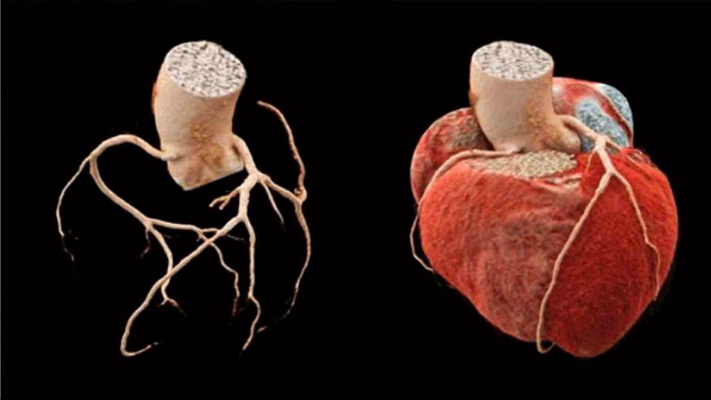 Cross-modality trainings for Cardiology