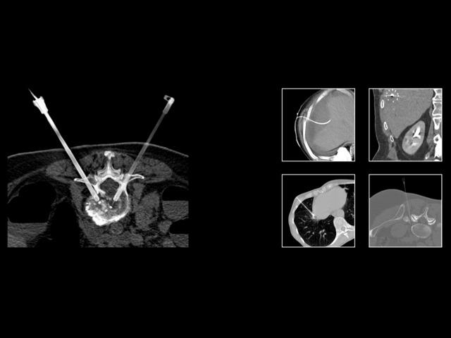 CT clinical imaging solutions screenshot