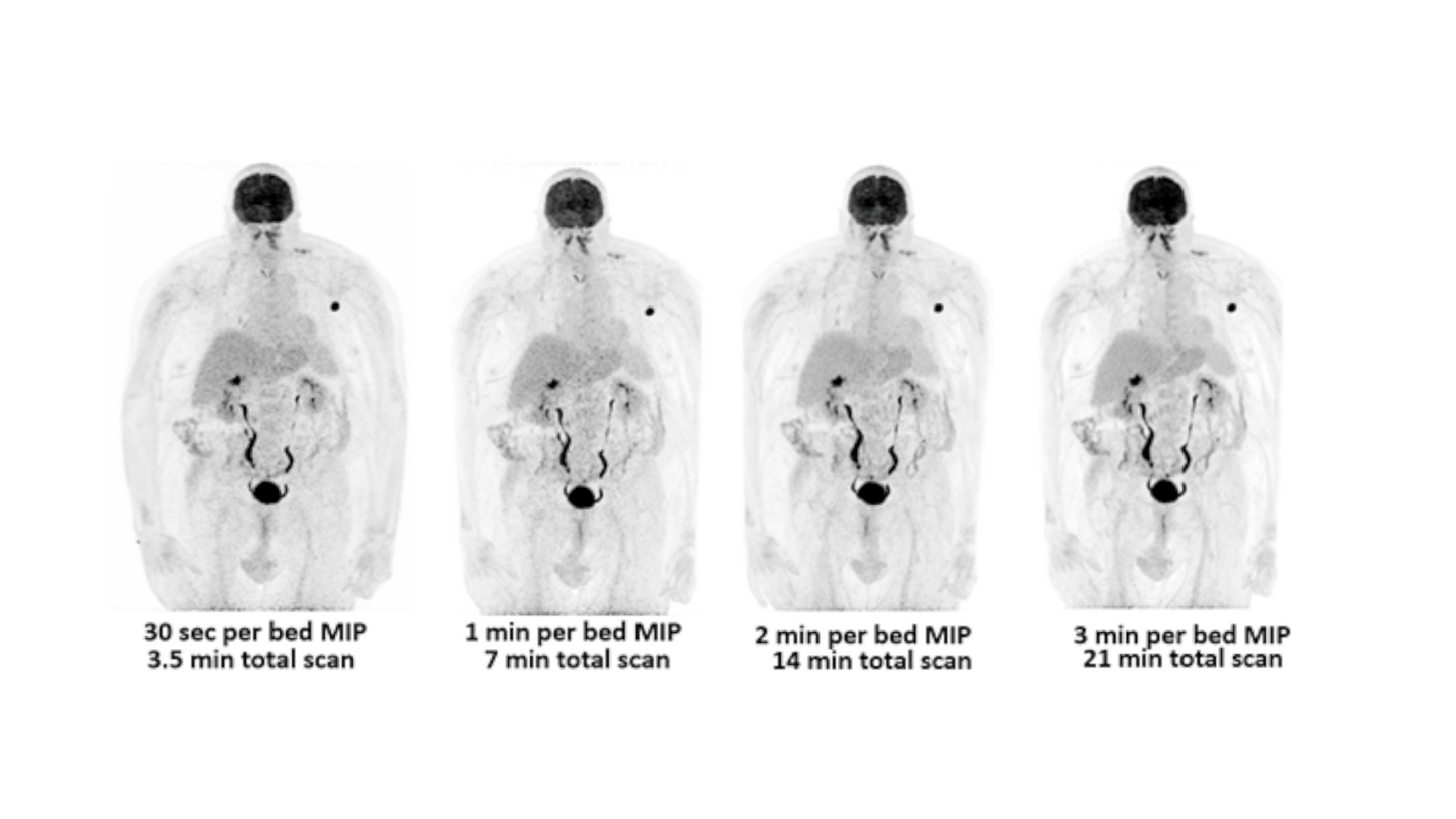 Biograph Vision clinical image