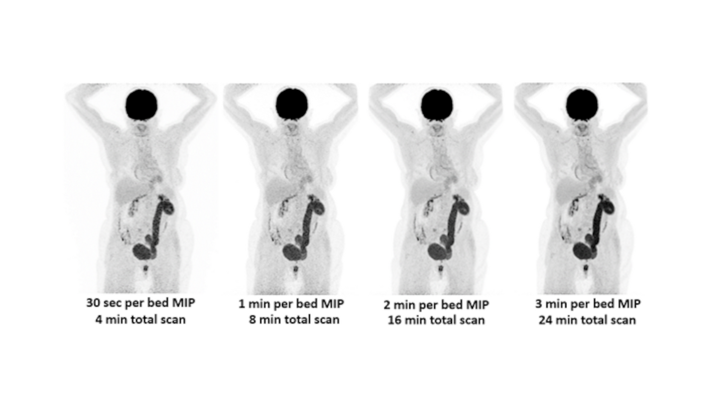 Biograph Vision clinical image 4