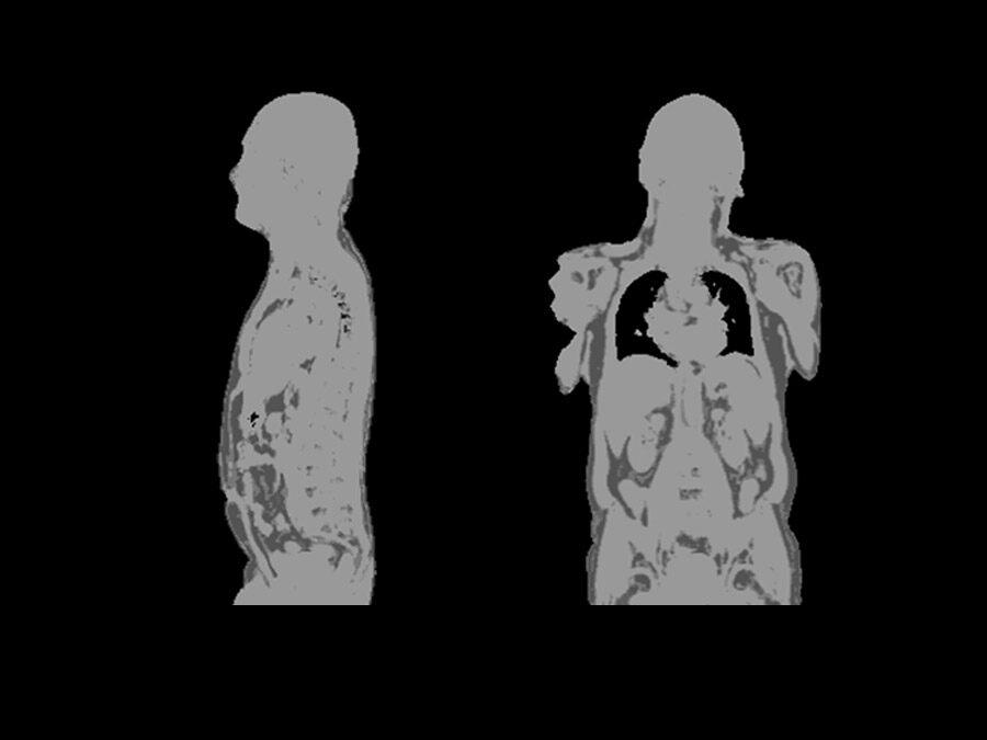 BodyCompass scan after