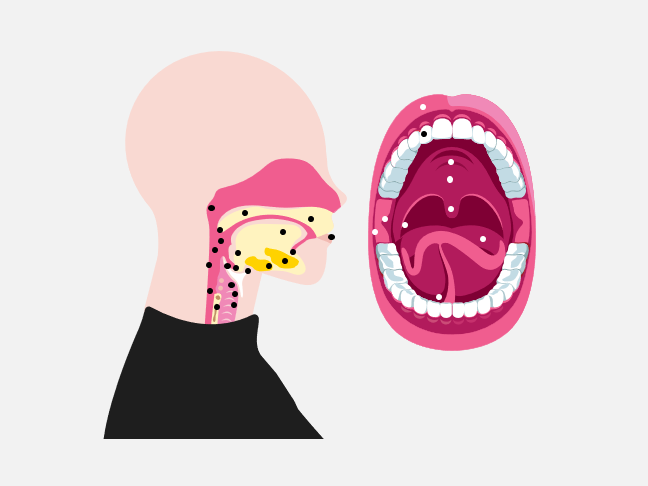 Head and neck cancer cites