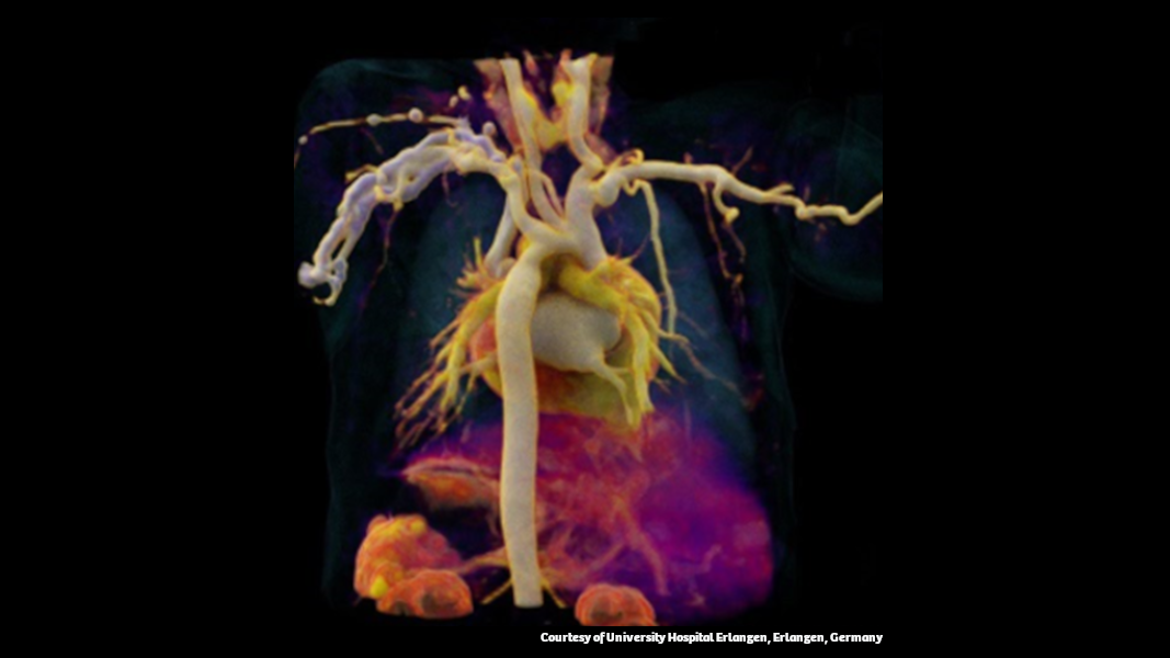 Image form Dual Source CT in cardiac imaging white paper